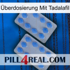 Überdosierung Mit Tadalafil 20